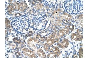 SLC38A4 antibody was used for immunohistochemistry at a concentration of 4-8 ug/ml to stain Epithelial cells of renal tubule (arrows) in Human Kidney. (SLC38A4 antibody  (Middle Region))