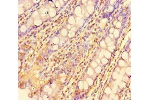 Immunohistochemistry of paraffin-embedded human colon tissue using ABIN7175986 at dilution of 1:100 (ZBTB46 antibody  (AA 174-362))