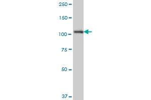 SH3MD2 monoclonal antibody (M01), clone 3H3 Western Blot analysis of SH3MD2 expression in HeLa . (SH3RF1 antibody  (AA 790-888))