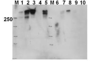 Image no. 1 for anti-Protein Kinase, DNA-Activated, Catalytic Polypeptide (PRKDC) (Thr2609) antibody (ABIN401263) (PRKDC antibody  (Thr2609))