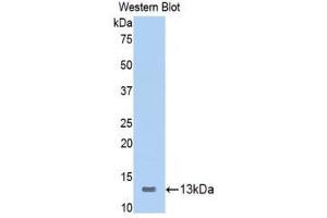 Western Blotting (WB) image for anti-Inducible T-Cell Co-Stimulator (ICOS) (AA 39-133) antibody (ABIN1173559) (ICOS antibody  (AA 39-133))
