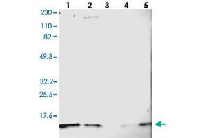 Western blot analysis of Lane 1: RT-4, Lane 2: U-251 MG, Lane 3: Human Plasma, Lane 4: Liver, Lane 5: Tonsil with DYNLT3 polyclonal antibody . (DYNLT3 antibody)