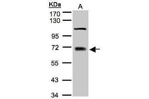 WB Image Sample(30 μg of whole cell lysate) A:A431 7. (TRIM25 antibody)