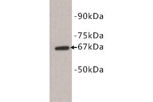 Western Blotting (WB) image for anti-Selectin E (SELE) (N-Term) antibody (ABIN1854888) (Selectin E/CD62e antibody  (N-Term))
