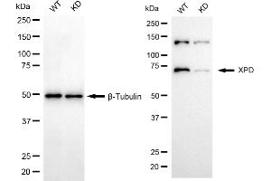 Western blotting analysis using XPD antibody (ABIN7798540).