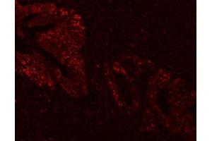 IF analysis of FEN1 using anti-FEN1 antibody (ABIN7601617).