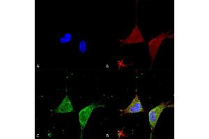 Immunocytochemistry/Immunofluorescence analysis using Mouse Anti-GABA A Receptor Alpha 5 Monoclonal Antibody, Clone S415-24 (ABIN2485763). (GABRA1 antibody  (Cytoplasmic Domain) (Biotin))