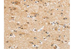 The image on the left is immunohistochemistry of paraffin-embedded Human brain tissue using ABIN7192978(UBTD2 Antibody) at dilution 1/35, on the right is treated with synthetic peptide. (UBTD2 antibody)