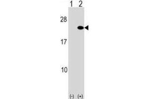 Western Blotting (WB) image for anti-ADP-Ribosylation Factor 5 (ARF5) antibody (ABIN2999205)