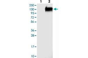 Western blot analysis of Lane 1: Negative control (vector only transfected HEK293T lysate), Lane 2: Over-expression Lysate (Co-expressed with a C-terminal myc-DDK tag (~3. (FAM184A antibody)