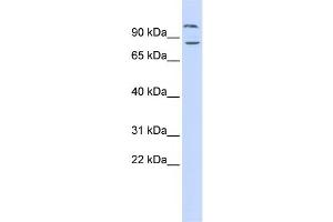 Western Blotting (WB) image for anti-Diacylglycerol Lipase, beta (DAGLB) antibody (ABIN2459904) (DAGLB antibody)