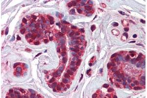 Human Breast: Formalin-Fixed, Paraffin-Embedded (FFPE) (CHFR antibody  (AA 36-85))
