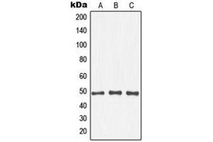 Western blot analysis of IKK beta (pT19) expression in Raw264. (IKBKB antibody  (N-Term, pSer19))