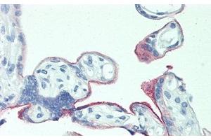 Detection of 0 in Human Placenta Tissue using Polyclonal Antibody to 5T4 (TPBG antibody  (AA 32-351))