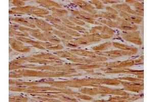 IHC image of ABIN7154398 diluted at 1:300 and staining in paraffin-embedded human heart tissue performed on a Leica BondTM system. (CSF3R antibody  (AA 117-337))