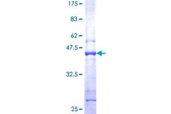 PFDN5 Protein (AA 1-154) (GST tag)