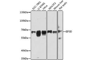 Western blot analysis of extracts of various cell lines, using EIF3D antibody. (EIF3D antibody)