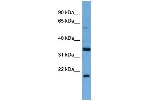 WB Suggested Anti-MIER2 Antibody Titration: 0. (MIER2 antibody  (Middle Region))