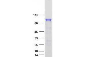 Validation with Western Blot (FOXO3 Protein (Transcript Variant 2) (Myc-DYKDDDDK Tag))