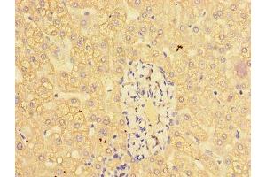 Immunohistochemistry of paraffin-embedded human liver tissue using ABIN7147018 at dilution of 1:100 (Cathepsin L antibody  (AA 114-288))
