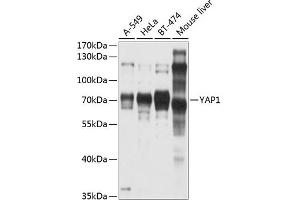 Western blot analysis of extracts of various cell lines, using Y antibody (ABIN6132788, ABIN6150316, ABIN6150321 and ABIN6215135) at 1:1000 dilution. (YAP1 antibody  (AA 155-504))