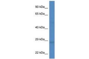 Image no. 1 for anti-Dickkopf 2 Homolog (DKK2) (AA 124-173) antibody (ABIN6749760) (DKK2 antibody  (AA 124-173))