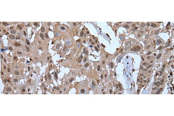 ZNF787 antibody
