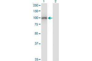 Western Blot analysis of DIP2A expression in transfected 293T cell line by DIP2A monoclonal antibody (M01), clone 4E6. (DIP2A antibody  (AA 107-301))