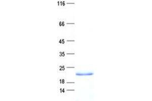 Validation with Western Blot (PPIA Protein (His tag))