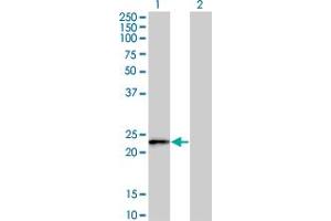 Western Blot analysis of FBXO36 expression in transfected 293T cell line by FBXO36 monoclonal antibody (M02), clone 3D3.