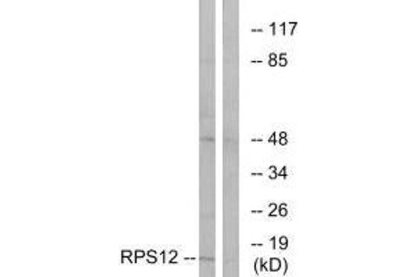 RPS12 antibody  (C-Term)
