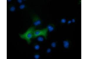 Anti-EPHX2 mouse monoclonal antibody (ABIN2452991) immunofluorescent staining of COS7 cells transiently transfected by pCMV6-ENTRY EPHX2 (RC202489). (EPHX2 antibody)