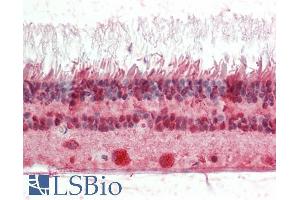 ABIN1590000 (5µg/ml) staining of paraffin embedded Human Retina. (CRX antibody  (Internal Region))