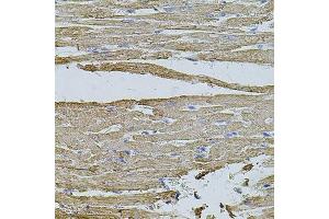 Immunohistochemistry of paraffin-embedded rat heart using HMMR antibody.