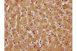 Immunohistochemistry of paraffin-embedded human liver tissue using ABIN7171480 at dilution of 1:100 (WRB antibody  (AA 38-99))