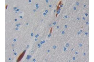 DAB staining on IHC-P; Samples: Human Brain Tissue (Hemoglobin, mu antibody  (AA 13-141))