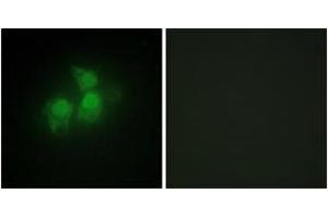 Immunofluorescence analysis of HepG2 cells, using IPPK Antibody. (IPPK antibody  (AA 11-60))