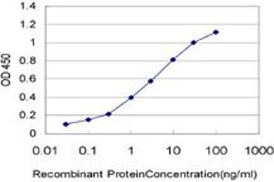 Detection limit for recombinant GST tagged ADH6 is approximately 0. (ADH6 antibody  (AA 55-144))