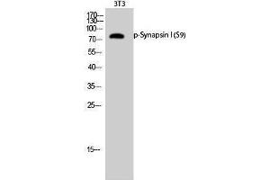 Western Blotting (WB) image for anti-Synapsin I (SYN1) (pSer9) antibody (ABIN3182156) (SYN1 antibody  (pSer9))