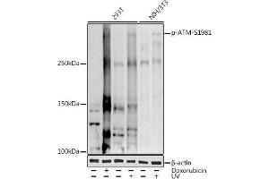 Western blot analysis of extracts of various cell lines, using (ABIN3019428, ABIN3019429, ABIN3019430 and ABIN6225361) at 1:1000 dilution.