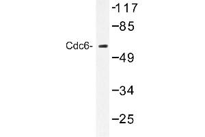 Image no. 1 for anti-Cell Division Cycle 6 Homolog (S. Cerevisiae) (CDC6) antibody (ABIN272277) (CDC6 antibody)