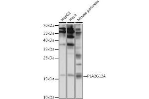 Western blot analysis of extracts of various cell lines, using PLG12A antibody (ABIN7269339) at 1:1000 dilution. (PLA2G12A antibody  (AA 1-100))