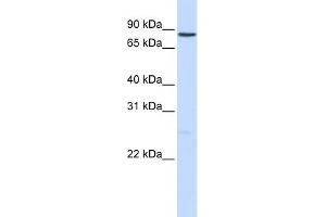 WB Suggested Anti-NOTCH1 Antibody Titration:  0. (Notch1 antibody  (Middle Region))