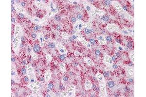 Anti-DAZ1 antibody IHC of human liver. (DAZ1 antibody  (AA 21-121))