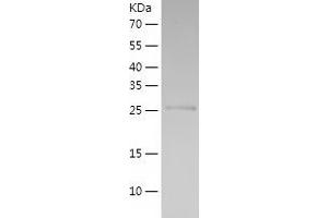 Western Blotting (WB) image for Hematopoietically Expressed Homeobox (HHEX) (AA 1-270) protein (His tag) (ABIN7123288) (HHEX Protein (AA 1-270) (His tag))