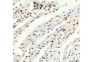 IHC analysis of TRIM63 using anti-TRIM63 antibody (ABIN3044380).
