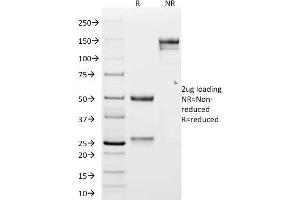 SDS-PAGE Analysis Purified N-Cadherin Mouse Monoclonal Antibody (CDH2/1573). (N-Cadherin antibody  (Intracellular))