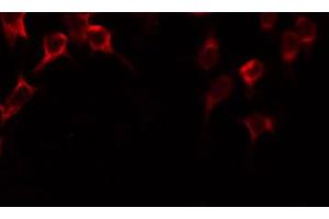 ABIN6268681 staining COLO205 by IF/ICC. (SIRT3 antibody  (C-Term))