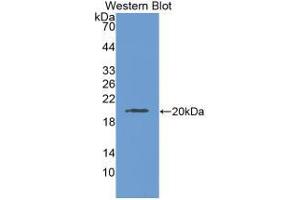 Western Blot ; Sample: Recombinant LAMC3, Human. (LAMC3 antibody  (AA 1250-1418))