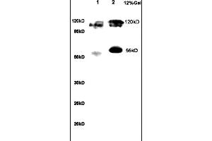 Formalin-fixed and paraffin embedded human gastric tissue labeled with Anti NRSF/REST Polyclonal Antibody,Unconjugated (ABIN747683) at 1:200 followed by conjugation to the secondary antibody and DAB staining. (REST antibody  (AA 401-450))
